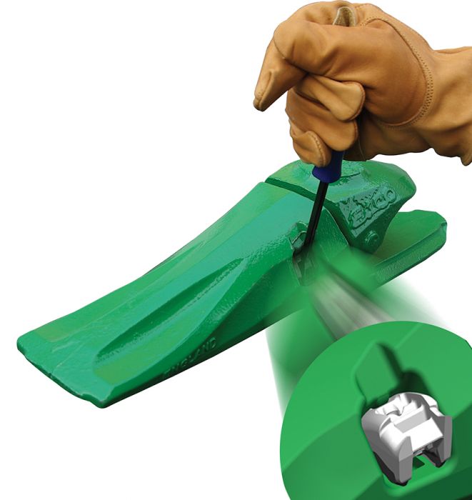 Ultralok Sistem zaključavanja zuba i adaptera